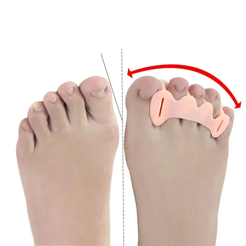 Toe Spacers - Peach